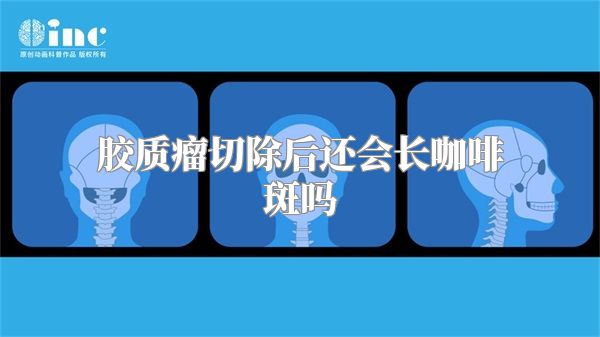 胶质瘤切除后还会长咖啡斑吗