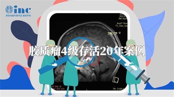 胶质瘤4级存活20年案例