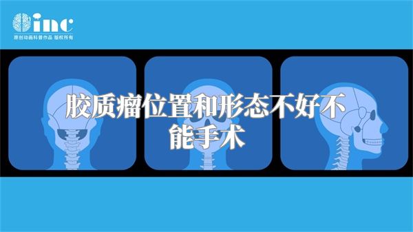 胶质瘤位置和形态不好不能手术