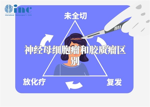 神经母细胞瘤和胶质瘤区别