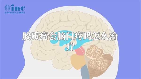 胶质瘤会脑门疼吗怎么治疗