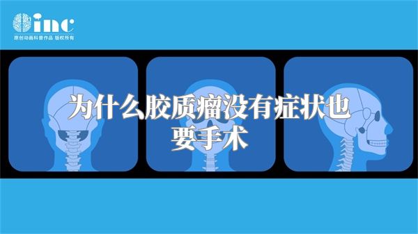 为什么胶质瘤没有症状也要手术