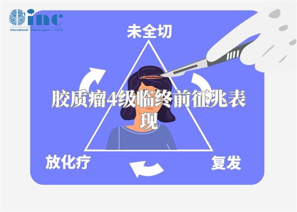 胶质瘤4级临终前征兆表现