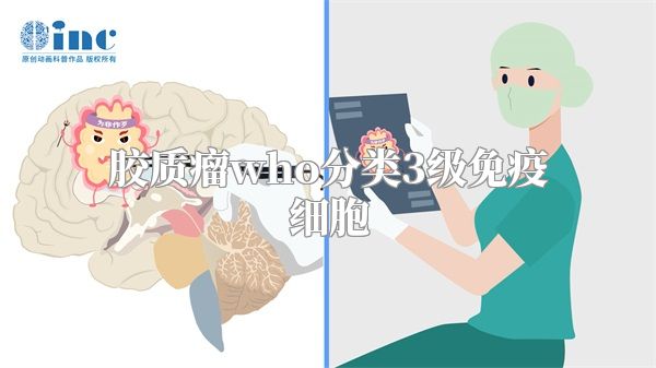 胶质瘤who分类3级免疫细胞