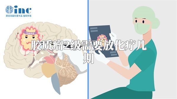 胶质瘤2级需要放化疗几期