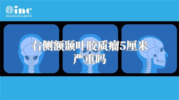 右侧额颞叶胶质瘤5厘米严重吗