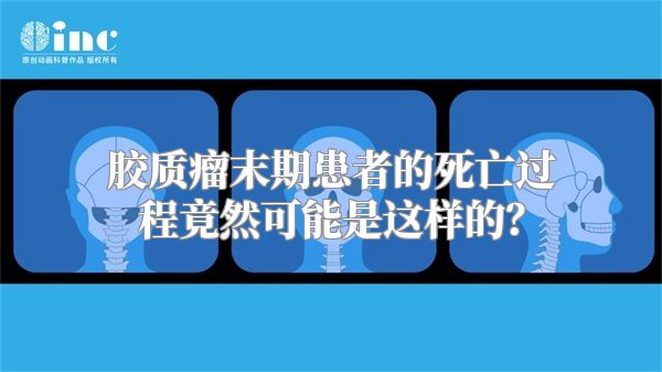 胶质瘤末期患者的死亡过程竟然可能是这样的？