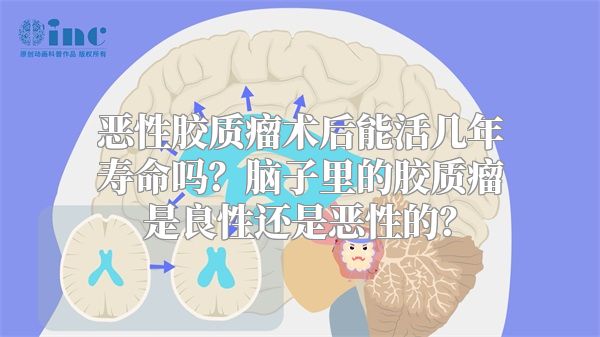 恶性胶质瘤术后能活几年寿命吗？脑子里的胶质瘤是良性还是恶性的？