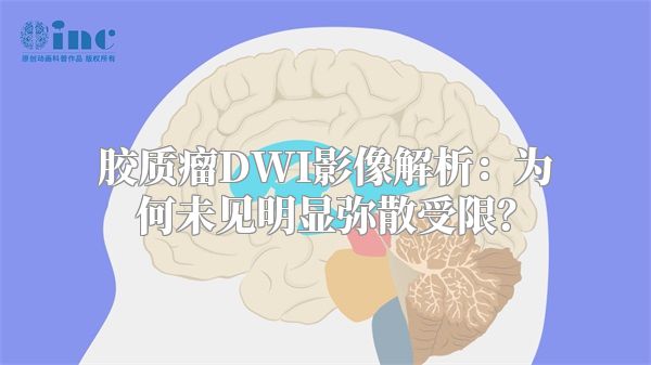 胶质瘤DWI影像解析：为何未见明显弥散受限？