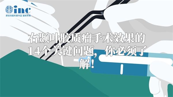 右颞叶胶质瘤手术效果的14个关键问题，你必须了解！