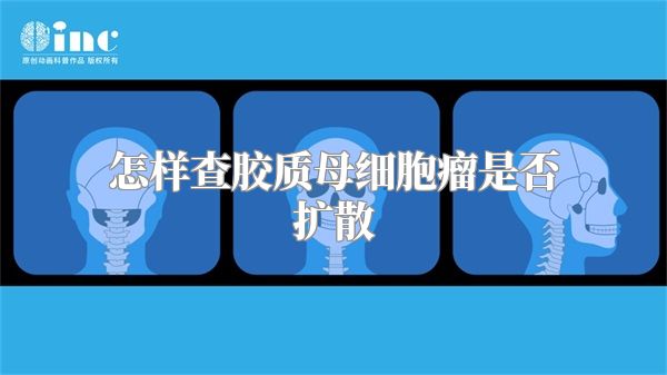 怎样查胶质母细胞瘤是否扩散