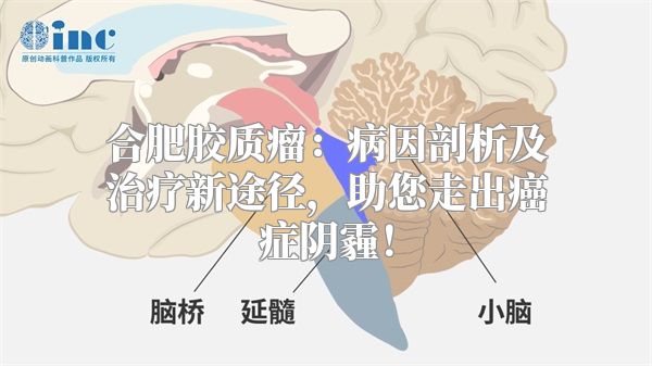 合肥胶质瘤：病因剖析及治疗新途径，助您走出癌症阴霾！