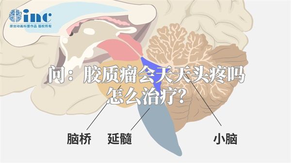 问：胶质瘤会天天头疼吗怎么治疗？