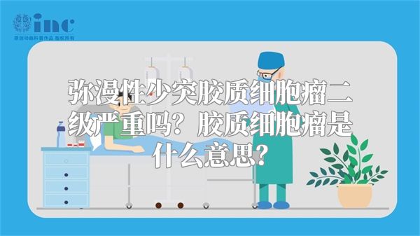 弥漫性少突胶质细胞瘤二级严重吗？胶质细胞瘤是什么意思？