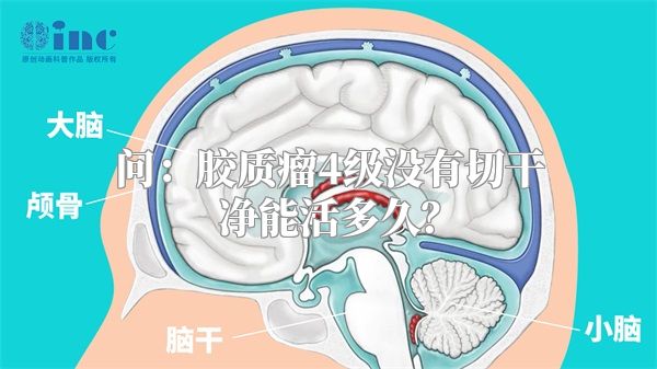 问：胶质瘤4级没有切干净能活多久？