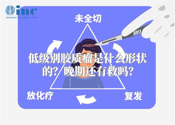 低级别胶质瘤是什么形状的？晚期还有救吗？