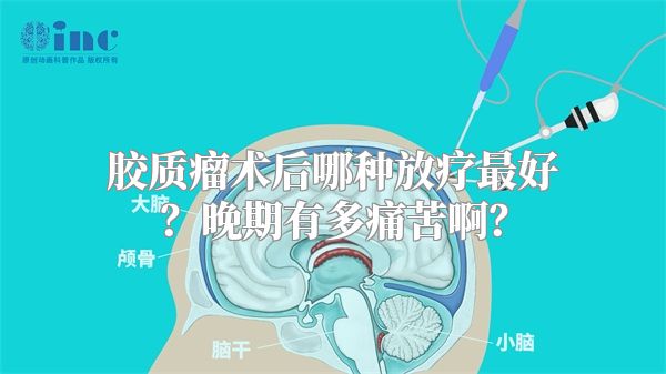 胶质瘤术后哪种放疗最好？晚期有多痛苦啊？