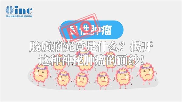 胶质瘤究竟是什么？揭开这种神秘肿瘤的面纱！