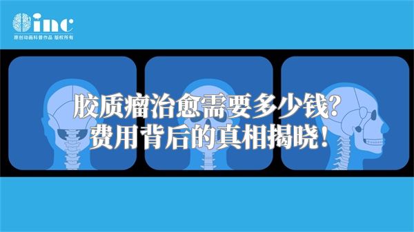 胶质瘤治愈需要多少钱？费用背后的真相揭晓！