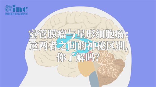 室管膜瘤与星形细胞瘤：这两者之间的神秘区别，你了解吗？