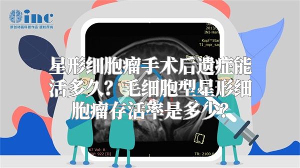 星形细胞瘤手术后遗症能活多久？毛细胞型星形细胞瘤存活率是多少？