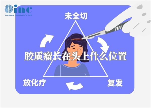 胶质瘤长在头上什么位置