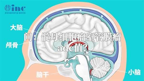 问：髓母细胞瘤室管膜瘤adc值？