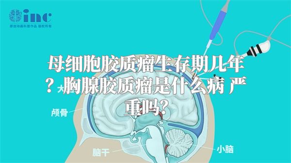 母细胞胶质瘤生存期几年？胸腺胶质瘤是什么病 严重吗？