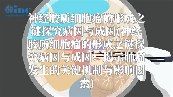 神经胶质细胞瘤的形成之谜探究病因与成因(神经胶质细胞瘤的形成之谜探究病因与成因：揭示肿瘤发生的关键机制与影响因素)