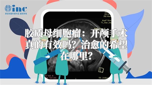 胶质母细胞瘤：开颅手术真的有效吗？治愈的希望在哪里？