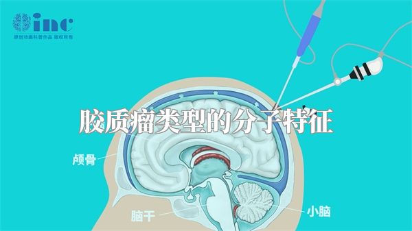 胶质瘤类型的分子特征