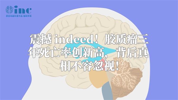 震撼 indeed！胶质瘤三年死亡率创新高，背后真相不容忽视！