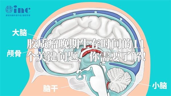 胶质瘤晚期生存时间的11个关键问题，你需要了解！