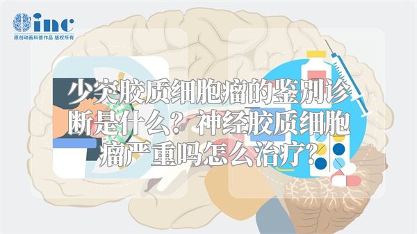 少突胶质细胞瘤的鉴别诊断是什么？神经胶质细胞瘤严重吗怎么治疗？