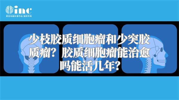 少枝胶质细胞瘤和少突胶质瘤？胶质细胞瘤能治愈吗能活几年？