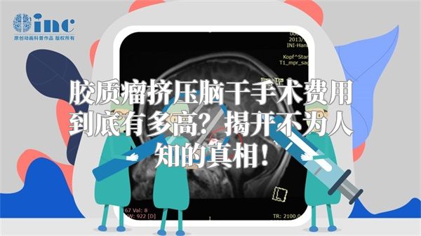 胶质瘤挤压脑干手术费用到底有多高？揭开不为人知的真相！