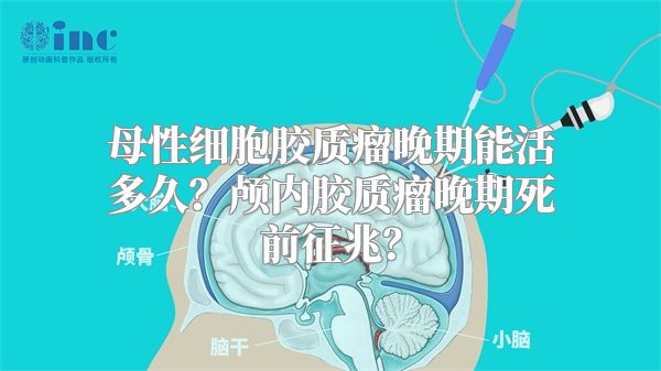 母性细胞胶质瘤晚期能活多久？颅内胶质瘤晚期死前征兆？