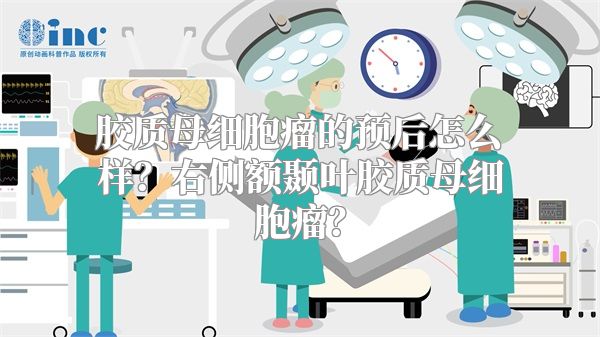 胶质母细胞瘤的预后怎么样？右侧额颞叶胶质母细胞瘤？