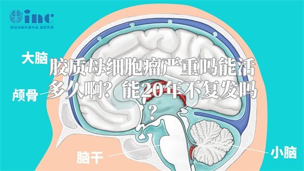 胶质母细胞瘤严重吗能活多久啊？能20年不复发吗？