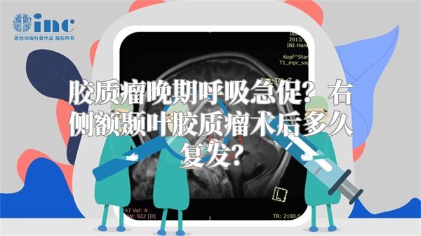 胶质瘤晚期呼吸急促？右侧额颞叶胶质瘤术后多久复发？