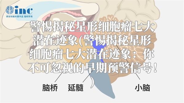 警惕揭秘星形细胞瘤七大潜在迹象(警惕揭秘星形细胞瘤七大潜在迹象：你不可忽视的早期预警信号！)