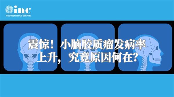 震惊！小脑胶质瘤发病率上升，究竟原因何在？