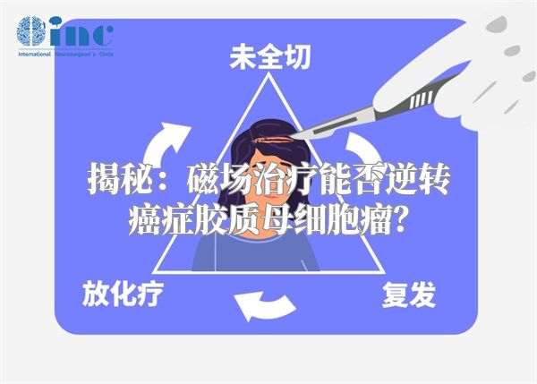 揭秘：磁场治疗能否逆转癌症胶质母细胞瘤？