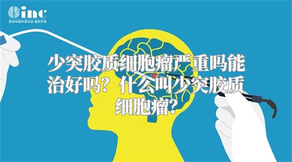 少突胶质细胞瘤严重吗能治好吗？什么叫少突胶质细胞瘤？