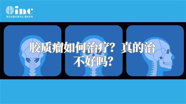 胶质瘤如何治疗？真的治不好吗？