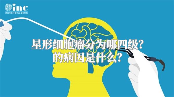 星形细胞瘤分为哪四级？的病因是什么？