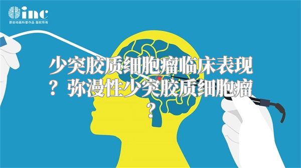 少突胶质细胞瘤临床表现？弥漫性少突胶质细胞瘤？