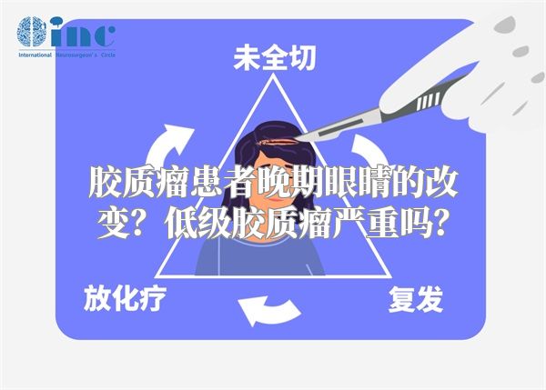 胶质瘤患者晚期眼睛的改变？低级胶质瘤严重吗？