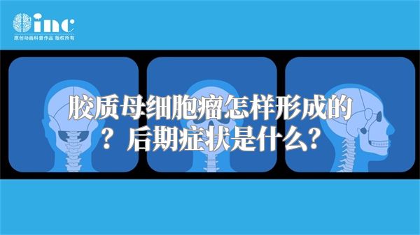 胶质母细胞瘤怎样形成的？后期症状是什么？