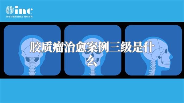 胶质瘤治愈案例三级是什么